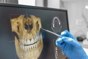 Dental clinician reviewing 3D CBCT imaging